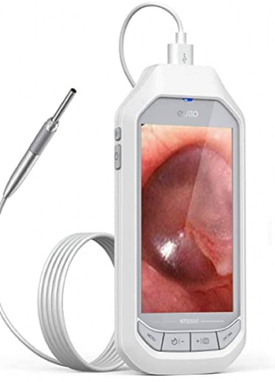 EuTTo NTE600  камера-отоскоп (заболевание уха) USB 3300 мА/TF- 32