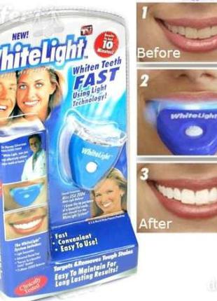 Отбеливание зубов отбеливатель White Light