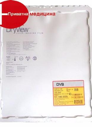 Термопленка Kodak DVB+ 35x43 (125 листов)
