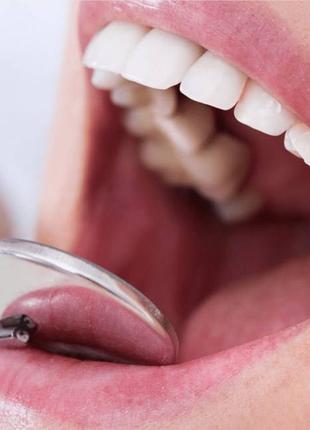 Лікування карієсу зубів, професійна гігієна порожнини рота.