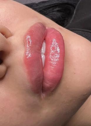 Перманентный макияж, Увеличение губ