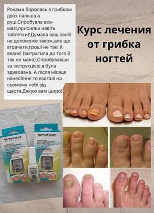 Лікування проти грибка нігтів