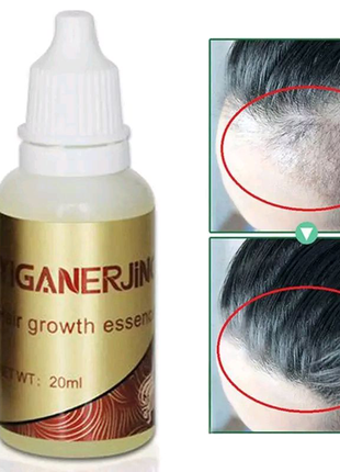 Емульсія для росту волосся Іганержинг / Yiganerjing / Иганержинг