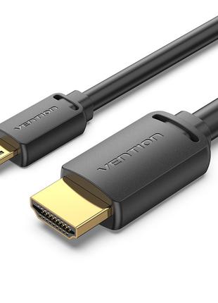 Кабель Micro HDMI-HDMI Vention, Длина 1.5м, Скорость передачи ...