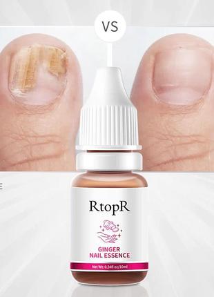 Защитный гель для восстановления ногтей rtopr ginger nail esse...