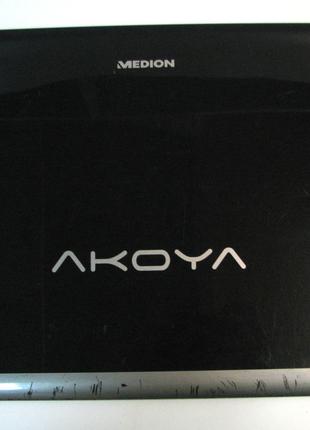 Крышка матрицы корпуса для ноутбука Medion Akoya E6234 13N0-ZE...
