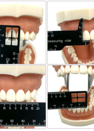 Лінійка для вимірювання зубів, двостороння, металева