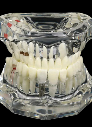 Демонстрационная модель зубов, прозрачная, частично разборная