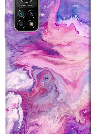 Чехол itsPrint Розовый мрамор 2 для Xiaomi Mi 10T