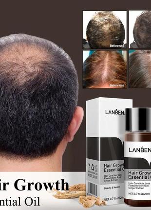 Олія для росту волосся з імбиром lanbena 20 ml