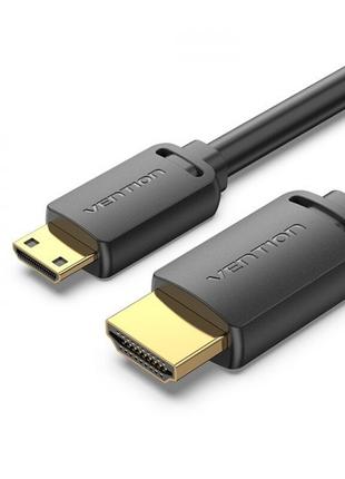 Кабель Vention HDMI — microHDMI, M/M, 1.5 м, чорний (AGIBG)