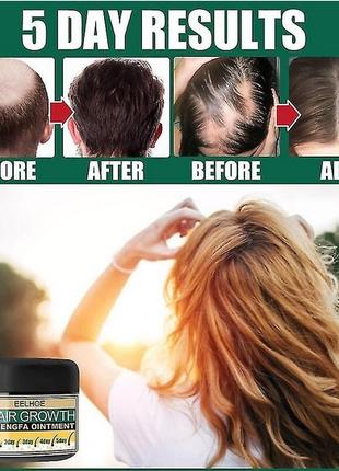 EELHOE Hair Growth Cream Крем для восстановления и роста волос...
