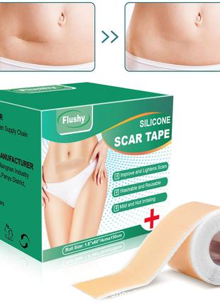 Силіконовий пластир від шрамів та рубців Silicone Scar Tape 4*...