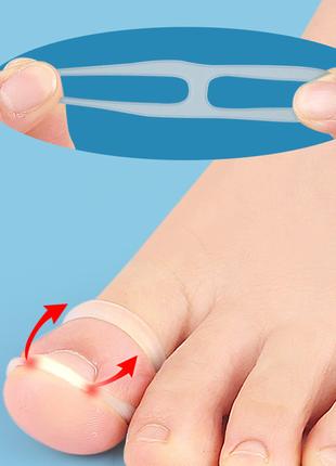 Силіконові кільця для корекції врослого нігтя Toe Nail Tool 2 ...