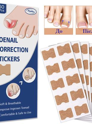 Пластир для корекції врослого нігтя Toenail Correction Sticker...