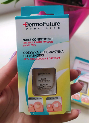 Курс лечения против грибка ногтей DermoFuture Польша